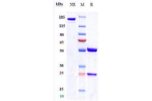 Anti-Nectin-4 Reference Antibody (enfortumab) on SDS-PAGE under reducing (R) condition.