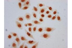 Immunocytochemistry analysis of ABIN7139157 diluted at 1:5 and staining in Hela cells (treated with 30mM sodium butyrate for 4h) performed on a Leica BondTM system.