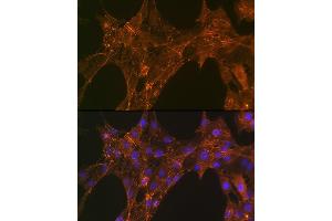 Immunofluorescence analysis of C6 cells using α-Actinin-4 Rabbit mAb (ABIN7265399) at dilution of 1:100 (40x lens).