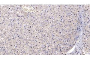 Detection of CR1 in Human Liver Tissue using Polyclonal Antibody to Complement Receptor 1, Erythrocyte (CR1) (CD35 anticorps  (AA 1780-2039))