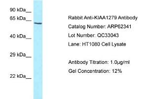 Western Blotting (WB) image for anti-KIAA1279 (KIAA1279) (C-Term) antibody (ABIN2774341) (KIF1BP anticorps  (C-Term))