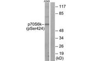 Western Blotting (WB) image for anti-Ribosomal Protein S6 Kinase, 70kDa, Polypeptide 1 (RPS6KB1) (pSer424) antibody (ABIN2888506) (RPS6KB1 anticorps  (pSer424))