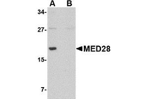 Western Blotting (WB) image for anti-Mediator Complex Subunit 28 (MED28) (Middle Region) antibody (ABIN1031001) (MED28 anticorps  (Middle Region))