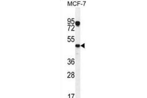 Western Blotting (WB) image for anti-Vascular Endothelial Growth Factor C (VEGFC) antibody (ABIN2996454) (VEGFC anticorps)