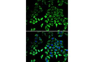 Immunofluorescence analysis of U2OS cells using PKM2 antibody . (PKM anticorps  (AA 11-221))