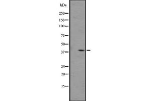 Western blot analysis of OPRL1 expression in A431 whole cell lysate ,The lane on the left is treated with the antigen-specific peptide. (OPRL1 anticorps  (C-Term))