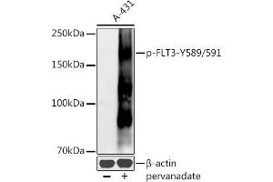 Western blot analysis of extracts of A-431 cells, using Phospho-FLT3-Y589/591 antibody (ABIN6135223, ABIN6136082, ABIN6136083 and ABIN6225559) at 1:500 dilution. (FLT3 anticorps  (pTyr589, pTyr591))