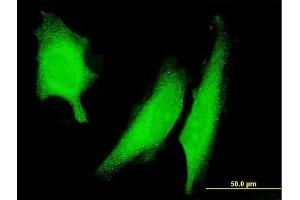 Immunofluorescence of monoclonal antibody to PRKAA2 on HeLa cell.