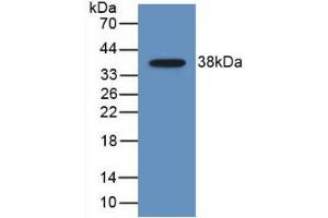Western blot analysis of recombinant Human MDC. (CCL22 anticorps  (AA 25-93))