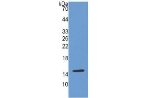 WB of Protein Standard: different control antibodies  against Highly purified E. (Cadherin 13 Kit ELISA)