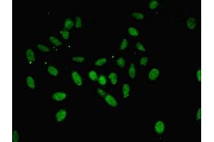Immunofluorescent analysis of Hela cells using ABIN7144263 at dilution of 1:100 and Alexa Fluor 488-congugated AffiniPure Goat Anti-Rabbit IgG(H+L)