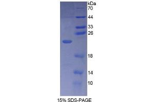 SDS-PAGE (SDS) image for phospholipase C, beta 1 (phosphoinositide-Specific) (PLCB1) (AA 316-476) protein (His tag) (ABIN4988764) (Phospholipase C beta 1 Protein (AA 316-476) (His tag))