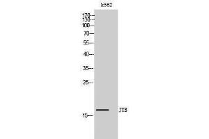 Western Blotting (WB) image for anti-Jumping Translocation Breakpoint (JTB) (N-Term) antibody (ABIN3175743) (JTB anticorps  (N-Term))