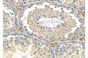 ABIN6262378 and ABIN6276997 at 1/100 staining Mouse testis tissue by IHC-P.