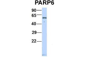 Host:  Rabbit  Target Name:  P Sample Type:  Human Fetal Heart  Antibody Dilution:  1. (PARP6 anticorps  (N-Term))