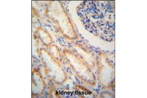 SHISA2 antibody immunohistochemistry analysis in formalin fixed and paraffin embedded human kidney tissue followed by peroxidase conjugation of the secondary antibody and DAB staining. (SHISA2 anticorps  (C-Term))