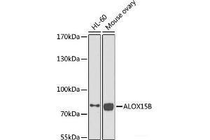 Western blot analysis of extracts of various cell lines using ALOX15B Polyclonal Antibody at dilution of 1:1000. (ALOX15B anticorps)