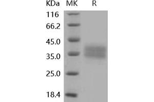Western Blotting (WB) image for Fc Fragment of IgG, Low Affinity IIb, Receptor (CD32) (FCGR2B) (Active) protein (His tag) (ABIN7195687)