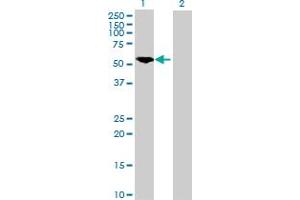 Western Blot analysis of PKM2 expression in transfected 293T cell line by PKM2 MaxPab polyclonal antibody. (PKM2 anticorps  (AA 1-531))