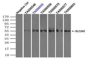 Image no. 3 for anti-Solute Carrier Family 2 (Facilitated Glucose/fructose Transporter), Member 5 (SLC2A5) antibody (ABIN1498479)