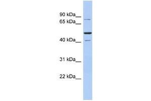 WB Suggested Anti-SSRP1 Antibody Titration:  0. (SSRP1 anticorps  (Middle Region))