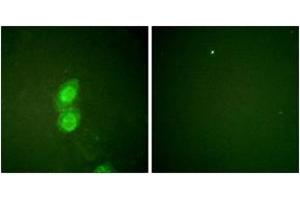 Immunofluorescence analysis of HuvEc cells, using Catenin-delta1 (Phospho-Tyr228) Antibody. (CTNND1 anticorps  (pTyr228))