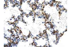 Rabbit Anti-NMI antibody        Paraffin Embedded Tissue:  Human Lung cell   Cellular Data:  Epithelial cells of renal tubule  Antibody Concentration:   4.