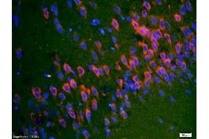 Formalin-fixed and paraffin-embedded rat brain labeled with Anti-SYTL5/slp5 Polyclonal Antibody, Unconjugated (ABIN754498) 1:200, overnight at 4°C, The secondary antibody was Goat Anti-Rabbit IgG, Cy3 conjugated used at 1:200 dilution for 40 minutes at 37°C.
