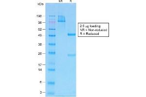 SDS-PAGE Analysis Purified PTH Rabbit Recombinant Monoclonal Antibody (PTH/1717R). (Recombinant PTH anticorps  (AA 1-34))