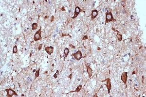 Immunohistochemistry of paraffin-embedded human brain using PRKRA/PACTRabbit mAb (ABIN7269666) at dilution of 1:100 (40x lens). (PRKRA anticorps)