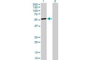 Western Blot analysis of DCTN2 expression in transfected 293T cell line by DCTN2 MaxPab polyclonal antibody. (Dynamitin anticorps  (AA 1-401))