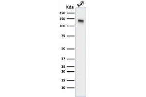 Western Blot Analysis of Raji cell lysate using CD22-Monospecific Mouse Monoclonal Antibody (BLCAM/1795).