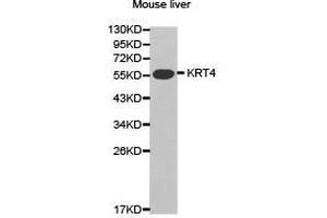 Western Blotting (WB) image for anti-Keratin 4 (KRT4) antibody (ABIN1873488) (KRT4 anticorps)