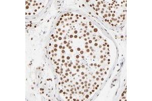 Immunohistochemical staining of human testis with ZNF540 polyclonal antibody  shows strong nuclear positivity in cells of seminiferus ducts. (ZNF540 anticorps)