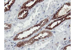 Immunohistochemical staining of paraffin-embedded Human Kidney tissue using anti-PFKP mouse monoclonal antibody. (PFKP anticorps)