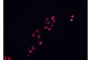 ABIN6276848 staining HepG2? (NR0B1 anticorps  (Internal Region))
