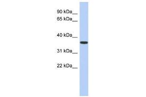 MVK antibody used at 1 ug/ml to detect target protein. (MVK anticorps  (N-Term))