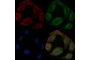 TBC1D21 Mouse Monoclonal Antibody staining Hela cells by IF/ICC. (TBC1D21 anticorps)