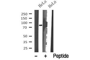 Western blot analysis of eIF2B in lysates of HeLa?