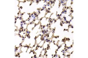 Immunohistochemistry of paraffin-embedded Mouse lung using KIF2B antibody at dilution of 1:100 (x400 lens). (KIF2B anticorps)