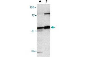 Western blot analysis of Casp12 in human (A) and mouse (B) spleen tissue lysates with Casp12 polyclonal antibody  at 1 ug/mL . (Caspase 12 anticorps  (AA 2-17))
