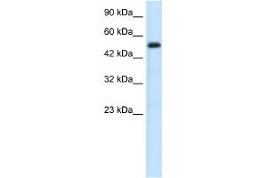 WB Suggested Anti-SMAD6 Antibody Titration:  0. (SMAD6 anticorps  (N-Term))