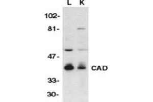 Image no. 1 for anti-DNA Fragmentation Factor, 40kDa, beta Polypeptide (Caspase-Activated DNase) (DFFB) (AA 314-329) antibody (ABIN201898) (DFFB anticorps  (AA 314-329))