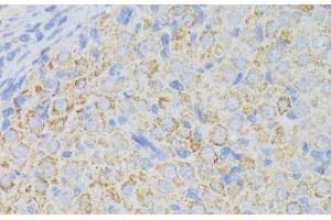 Immunohistochemistry of paraffin-embedded Rat ovary using ACADL Polyclonal Antibody at dilution of 1:100 (40x lens). (ACADL anticorps)