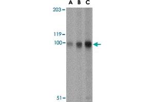Western blot analysis of STIM2 in A-20 cell lysate with STIM2 polyclonal antibody  at (A) 0.