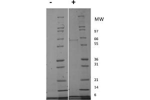 SDS-PAGE of Human Insulin-like Growth Factor I Recombinant Protein (Animal Free) SDS-PAGE of Human Insulin-like Growth Factor I Animal Free Recombinant Protein.