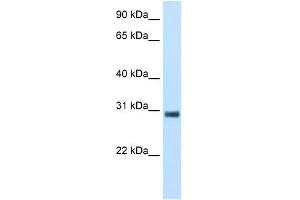 WB Suggested Anti-KCTD6 Antibody Titration:  5. (KCTD6 anticorps  (N-Term))