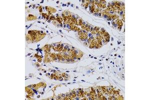 Immunohistochemistry of paraffin-embedded human stomach using CDK7 antibody (ABIN3022404, ABIN3022405, ABIN3022406 and ABIN6218792) at dilution of 1:200 (40x lens).
