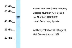 Western Blotting (WB) image for anti-ADP-Ribosylation Factor GTPase Activating Protein 3 (ARFGAP3) (C-Term) antibody (ABIN2788930) (ARFGAP3 anticorps  (C-Term))