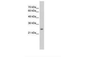 Image no. 1 for anti-NMDA Receptor Synaptonuclear Signaling and Neuronal Migration Factor (NSMF) (AA 283-332) antibody (ABIN203421)